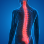 Spinal decompression therapy can help alleviate pressure on the nervous system and also provide relief